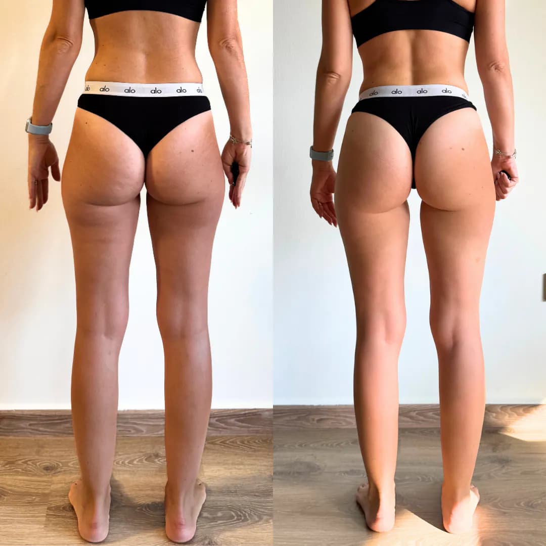 Transformation posture avant / après