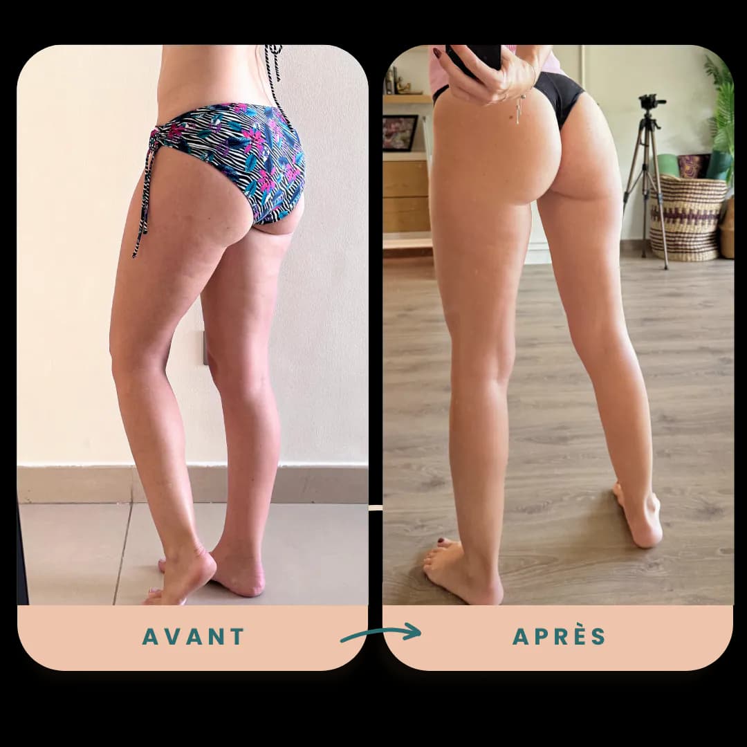 Transformation posture avant / après